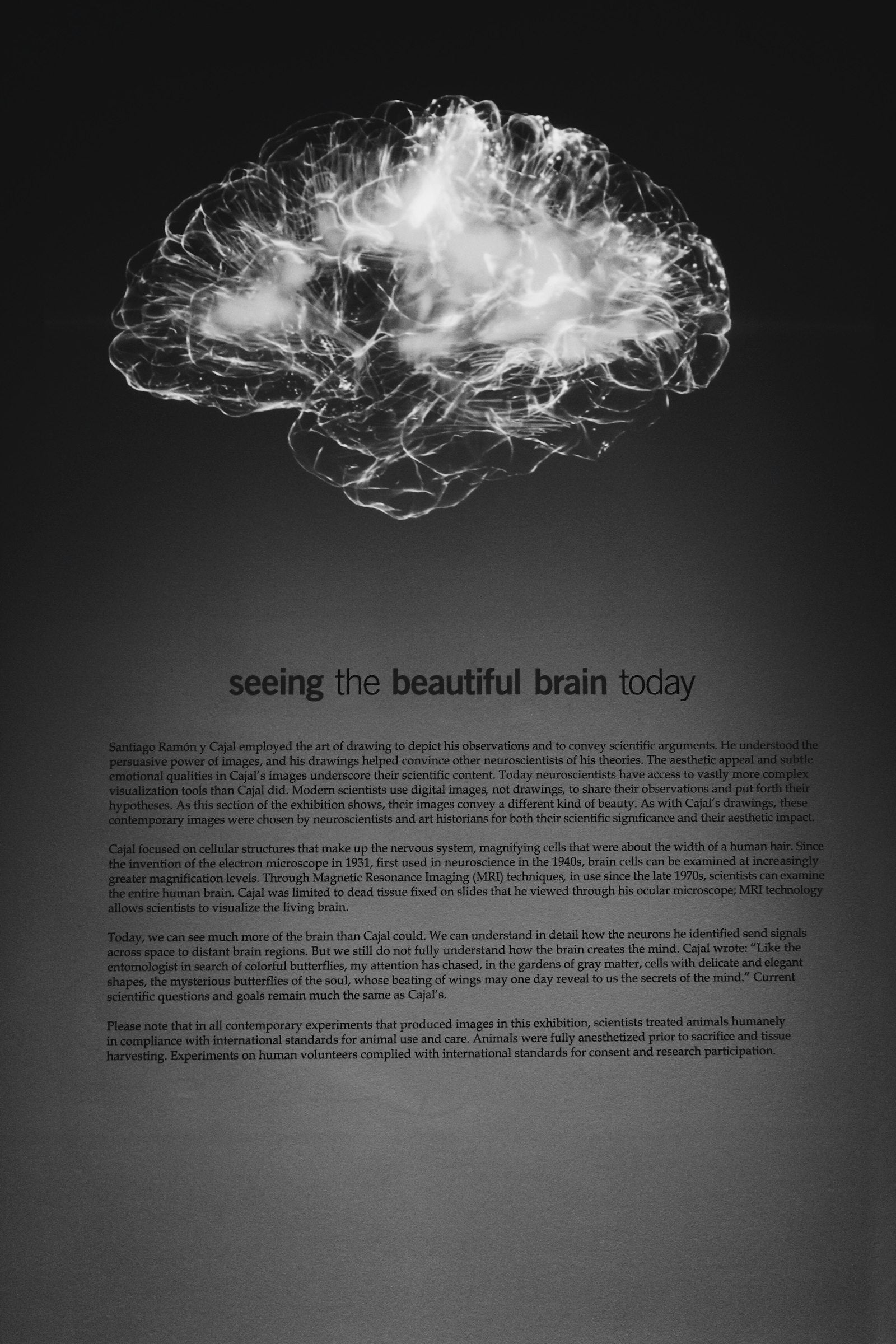 Cerveau brain fog brouillard cerebral — protocole 90 jours hydrogene moleculaire H2 Image